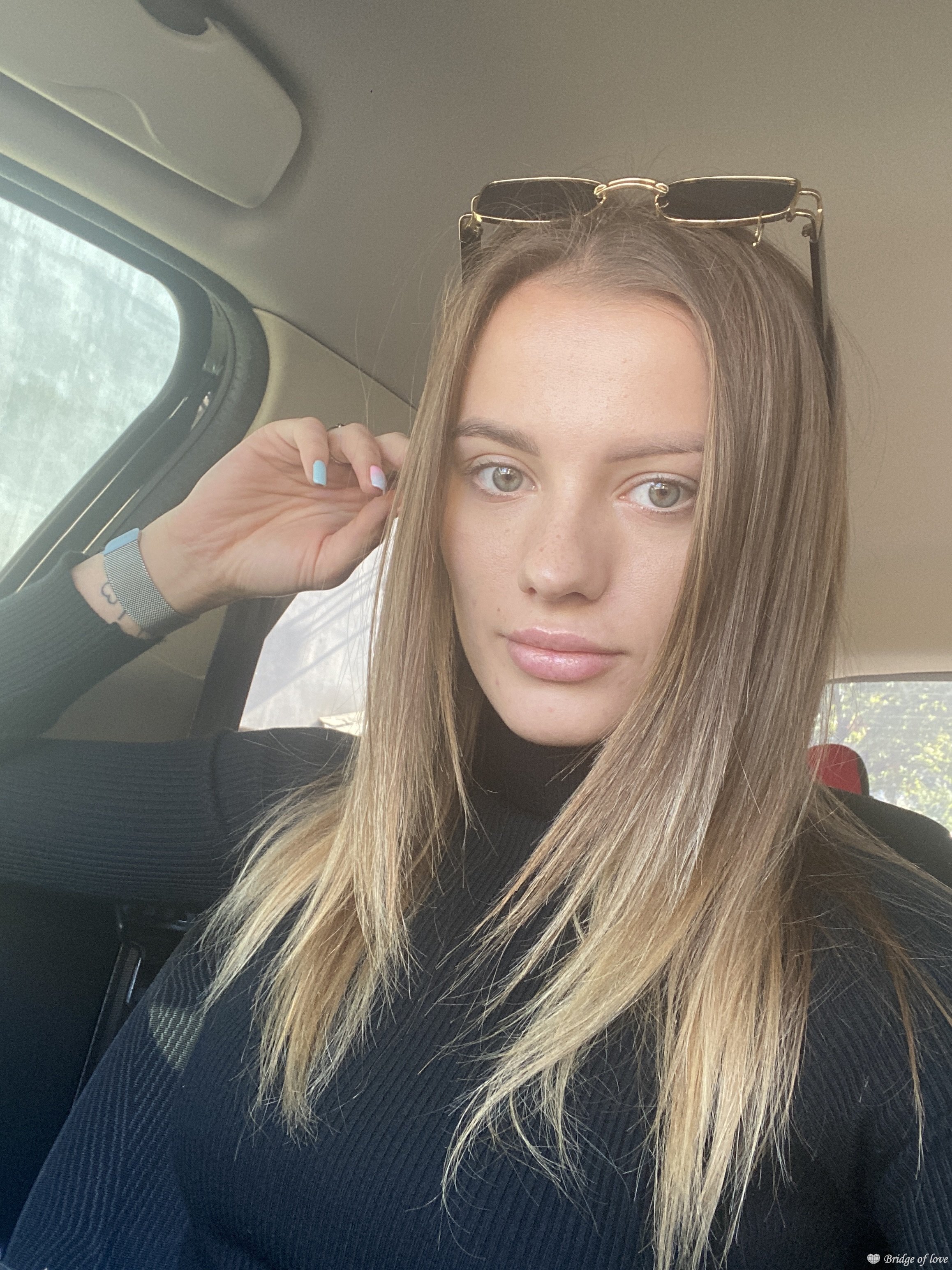Albina